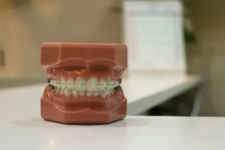 Özel Gereksinimli Çocuklarda Diş Muayenesine Hazırlık Nasıl Yapılır?